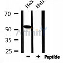Western blot analysis of extracts from Hela, using TINF2 Antibody.