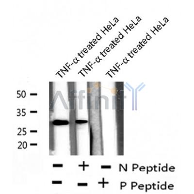 AF8246 staining HepG2 by IF/ICC. The sample were fixed with PFA and permeabilized in 0.1% Triton X-100,then blocked in 10% serum for 45 minutes at 25¡ãC. The primary antibody was diluted at 1/200 and incubated with the sample for 1 hour at 37¡ãC. An  Alexa Fluor 594 conjugated goat anti-rabbit IgG (H+L) Ab, diluted at 1/600, was used as the secondary antibod