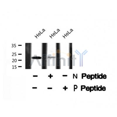AF8256 at 1/200 staining Rat kidney tissue sections by IHC-P. The tissue was formaldehyde fixed and a heat mediated antigen retrieval step in citrate buffer was performed. The tissue was then blocked and incubated with the antibody for 1.5 hours at 22¡ãC. An HRP conjugated goat anti-rabbit antibody was used as the secondary