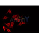 AF0441 staining HeLa by IF/ICC. The sample were fixed with PFA and permeabilized in 0.1% Triton X-100,then blocked in 10% serum for 45 minutes at 25¡ãC. The primary antibody was diluted at 1/200 and incubated with the sample for 1 hour at 37¡ãC. An  Alexa Fluor 594 conjugated goat anti-rabbit IgG (H+L) Ab, diluted at 1/600, was used as the secondary antibod