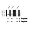 Western blot analysis FKHRL1 (Phospho-Ser318) using A549 whole cell lysates