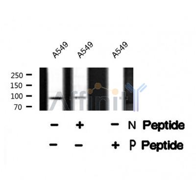 Western blot analysis FKHRL1 (Phospho-Ser318) using A549 whole cell lysates