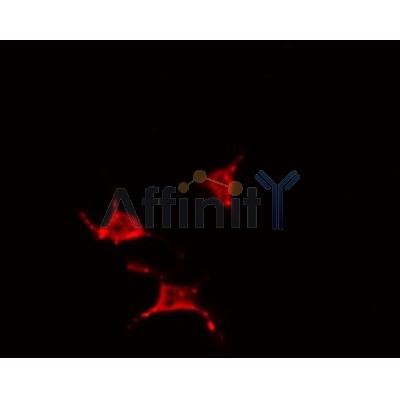 AF0462 staining 293 by IF/ICC. The sample were fixed with PFA and permeabilized in 0.1% Triton X-100,then blocked in 10% serum for 45 minutes at 25¡ãC. The primary antibody was diluted at 1/200 and incubated with the sample for 1 hour at 37¡ãC. An  Alexa Fluor 594 conjugated goat anti-rabbit IgG (H+L) Ab, diluted at 1/600, was used as the secondary antibod
