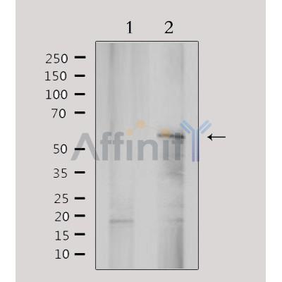Western blot analysis of extracts from rat brain, using YTHDF1 Antibody. Lane 1 was treated with the antigen-specific peptide.