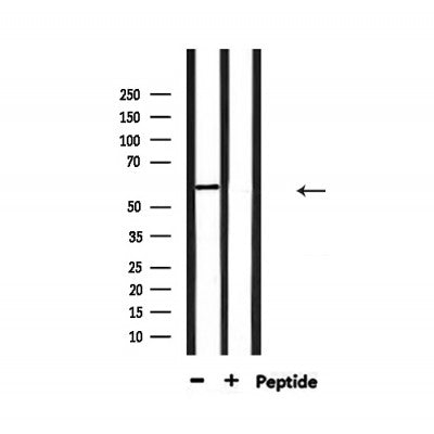 Western blot analysis of extracts from 293, using YTHDF1 Antibody.
