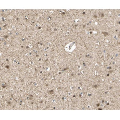 AF0171 at 1/100 staining human brain tissue sections by IHC-P. The tissue was formaldehyde fixed and a heat mediated antigen retrieval step in citrate buffer was performed. The tissue was then blocked and incubated with the antibody for 1.5 hours at 22¡ãC. An HRP conjugated goat anti-rabbit antibody was used as the secondary