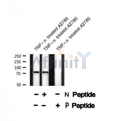 Western blot analysis of MKP-7 (Phospho-Ser446) using TNF-? treated A2780 whole cell lysates