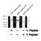 Western blot analysis of PDX1 (Phospho-Ser61) using EGF treated A431 whole cell lysates