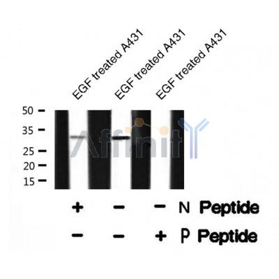 Western blot analysis of PDX1 (Phospho-Ser61) using EGF treated A431 whole cell lysates