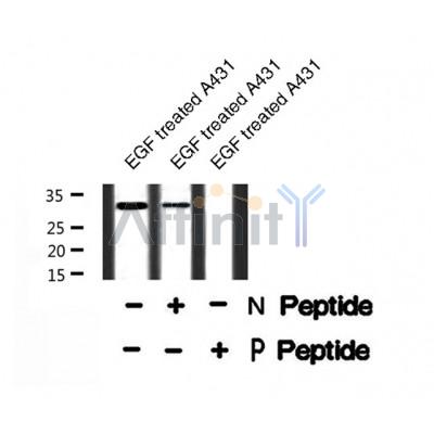 Western blot analysis of PDX1 (Phospho-Ser66) using EGF treated A431 whole cell lysates