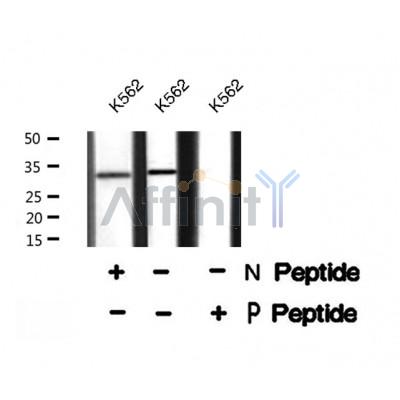 AF8310 staining HeLa by IF/ICC. The sample were fixed with PFA and permeabilized in 0.1% Triton X-100,then blocked in 10% serum for 45 minutes at 25¡ãC. The primary antibody was diluted at 1/200 and incubated with the sample for 1 hour at 37¡ãC. An  Alexa Fluor 594 conjugated goat anti-rabbit IgG (H+L) Ab, diluted at 1/600, was used as the secondary antibod