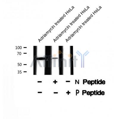 Western blot analysis SGO1 (Phospho-Ser14) using Adriamycin treated HeLa whole cell lysates