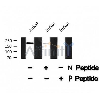 Western blot analysis SRC-1 (Phospho-Thr1179) using Jurkat whole cell lysates