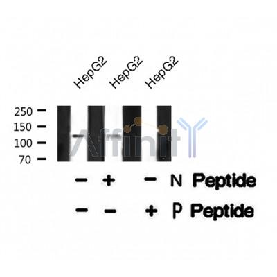 Western blot analysis SREBP-2 (Phospho-Ser455) using HepG2 whole cell lysates