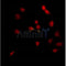 AF0442 staining RAW264.7 by IF/ICC. The sample were fixed with PFA and permeabilized in 0.1% Triton X-100,then blocked in 10% serum for 45 minutes at 25¡ãC. The primary antibody was diluted at 1/200 and incubated with the sample for 1 hour at 37¡ãC. An  Alexa Fluor 594 conjugated goat anti-rabbit IgG (H+L) Ab, diluted at 1/600, was used as the secondary antibod
