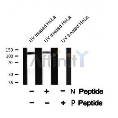 Western blot analysis USP28 (Phospho-Ser67) using UV treated HeLa whole cell lysates