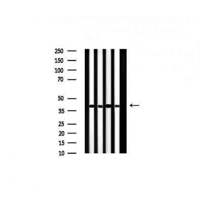 AF0526 staining Hela by IF/ICC. The sample were fixed with PFA and permeabilized in 0.1% Triton X-100,then blocked in 10% serum for 45 minutes at 25¡ãC. The primary antibody was diluted at 1/200 and incubated with the sample for 1 hour at 37¡ãC. An  Alexa Fluor 594 conjugated goat anti-rabbit IgG (H+L) Ab, diluted at 1/600, was used as the secondary antibod