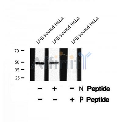 AF8341 staining HepG2 by IF/ICC. The sample were fixed with PFA and permeabilized in 0.1% Triton X-100,then blocked in 10% serum for 45 minutes at 25¡ãC. The primary antibody was diluted at 1/200 and incubated with the sample for 1 hour at 37¡ãC. An  Alexa Fluor 594 conjugated goat anti-rabbit IgG (H+L) Ab, diluted at 1/600, was used as the secondary antibod