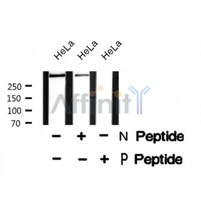 Western blot analysis IP3 Receptor (Phospho-Tyr353) using HeLa whole cell lysates