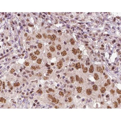 AF0490 at 1/100 staining human liver tissue sections by IHC-P. The tissue was formaldehyde fixed and a heat mediated antigen retrieval step in citrate buffer was performed. The tissue was then blocked and incubated with the antibody for 1.5 hours at 22¡ãC. An HRP conjugated goat anti-rabbit antibody was used as the secondary