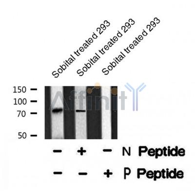 Western blot analysis of extracts from rat brain, using PKC ? (Phospho-Thr514) Antibody.