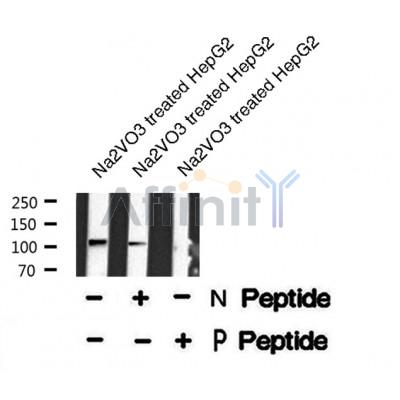 Western blot analysis of PRK1/2 (Phospho-Thr774/816) using Na2VO3 treated HepG2 whole cell lysates