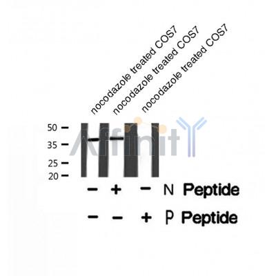 Western blot analysis of C5AR1 (Phospho-Ser334) using nocodazole treated COS7 whole cell lysates