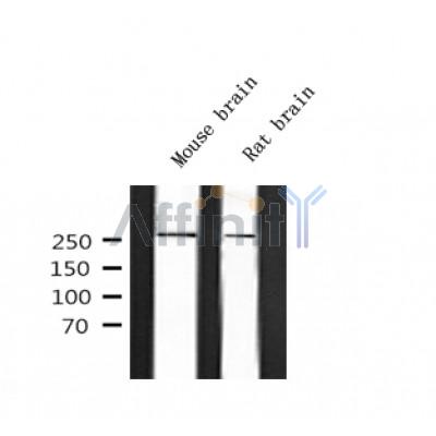 Western blot analysis of CACNA1C (Phospho-Ser1927) using EGF treated A431 whole cell lysates