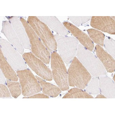 AF0741 staining U-2 OS cells by IF/ICC. The sample were fixed with PFA and permeabilized in 0.1% Triton X-100,then blocked in 10% serum for 45 minutes at 25¡ãC. The primary antibody was diluted at 1/200 and incubated with the sample for 1 hour at 37¡ãC. An  Alexa Fluor 594 conjugated goat anti-rabbit IgG (H+L) antibody(Cat.