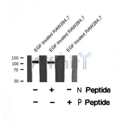 Western blot analysis of DDEF2 (Phospho-Ser701) using EGF treated RAW264.7 whole cell lysates
