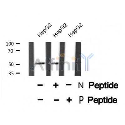 AF8371 staining HeLa cells by IF/ICC. The sample were fixed with PFA and permeabilized in 0.1% Triton X-100,then blocked in 10% serum for 45 minutes at 25¡ãC. The primary antibody was diluted at 1/200 and incubated with the sample for 1 hour at 37¡ãC. An  Alexa Fluor 594 conjugated goat anti-rabbit IgG (H+L) antibody(Cat.