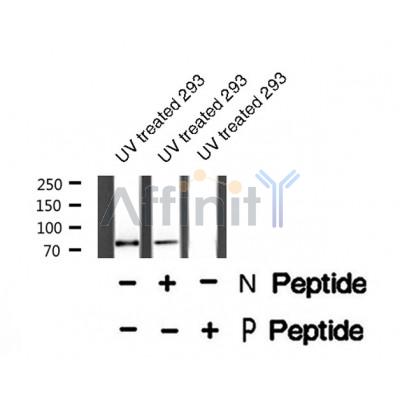 AF8377 staining Hela cells by IF/ICC. The sample were fixed with PFA and permeabilized in 0.1% Triton X-100,then blocked in 10% serum for 45 minutes at 25¡ãC. The primary antibody was diluted at 1/200 and incubated with the sample for 1 hour at 37¡ãC. An  Alexa Fluor 594 conjugated goat anti-rabbit IgG (H+L) antibody(Cat.