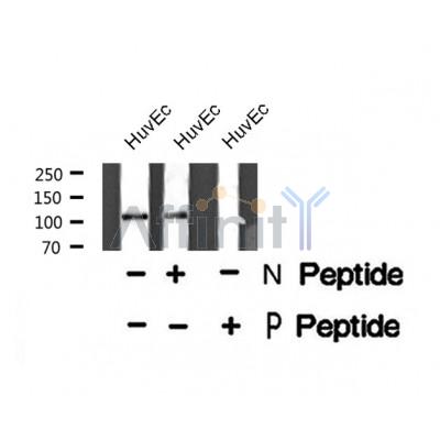 AF8378 staining HepG2 by IF/ICC. The sample were fixed with PFA and permeabilized in 0.1% Triton X-100,then blocked in 10% serum for 45 minutes at 25¡ãC. The primary antibody was diluted at 1/200 and incubated with the sample for 1 hour at 37¡ãC. An  Alexa Fluor 594 conjugated goat anti-rabbit IgG (H+L) Ab, diluted at 1/600, was used as the secondary antibod