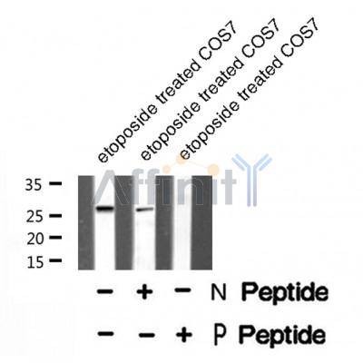 Western blot analysis of extracts from rat brain, mouse brain and Hela, using HSPB1 (Phospho-Ser15) Antibody.