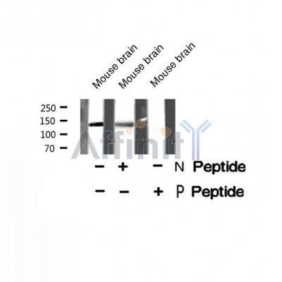Western blot analysis IRS2 (Phospho-Ser1100) using Mouse brain tissue lysates