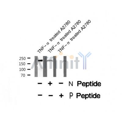 Western blot analysis of MLCK (Phospho-Tyr464) using TNF-? treated A2780 whole cell lysates