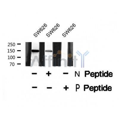 AF8391 staining HepG2 cells by IF/ICC. The sample were fixed with PFA and permeabilized in 0.1% Triton X-100,then blocked in 10% serum for 45 minutes at 25¡ãC. The primary antibody was diluted at 1/200 and incubated with the sample for 1 hour at 37¡ãC. An  Alexa Fluor 594 conjugated goat anti-rabbit IgG (H+L) antibody(Cat.