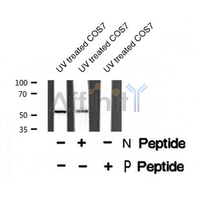 Western blot analysis of PPARA (Phospho-Ser12) using UV treated COS7 whole cell lysates