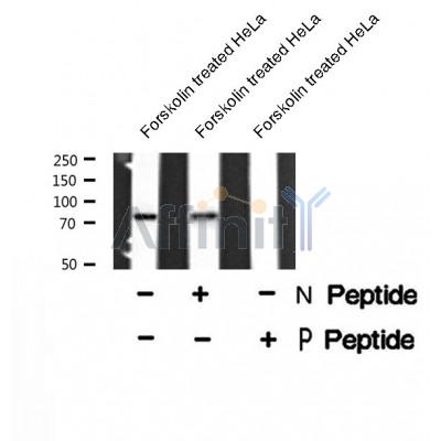 Western blot analysis of extracts from HepG2 serum starvation treated, using Phospho-PRKCA (Ser657) Antibody. The lane on the left was treated with blocking peptide.