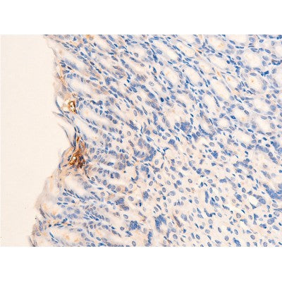 AF3036 staining 293 by IF/ICC. The sample were fixed with PFA and permeabilized in 0.1% Triton X-100,then blocked in 10% serum for 45 minutes at 25¡ãC. The primary antibody was diluted at 1/200 and incubated with the sample for 1 hour at 37¡ãC. An  Alexa Fluor 594 conjugated goat anti-rabbit IgG (H+L) Ab, diluted at 1/600, was used as the secondary antibod