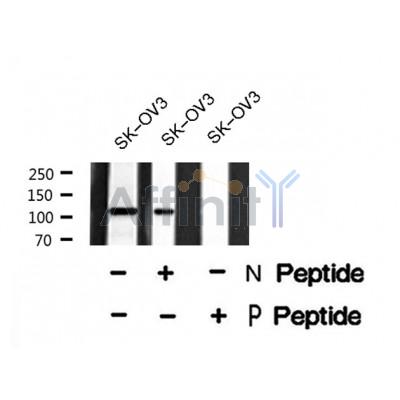 Western blot analysis of Retinoblastoma (Phospho-Thr373) using SK-OV3 whole cell lysates