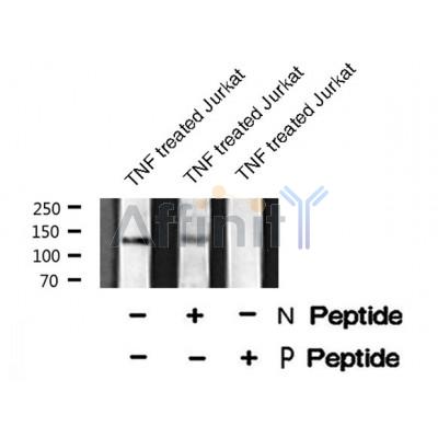 Western blot analysis of RBL2 (Phospho-Ser639) using TNF treated Jurkat whole cell lysates