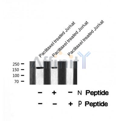 Western blot analysis of ROCK2 (Phospho-Tyr722) using Paclitaxel treated Jurkat whole cell lysates