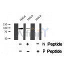 Western blot analysis of Androgen Receptor (Phospho-Ser791) using HeLa whole cell lysates
