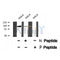 Western blot analysis of Androgen Receptor (Phospho-Ser791) using HeLa whole cell lysates