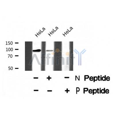 Western blot analysis of Androgen Receptor (Phospho-Ser791) using HeLa whole cell lysates