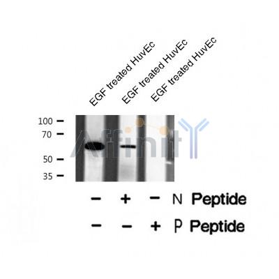 AF8415 staining 293 by IF/ICC. The sample were fixed with PFA and permeabilized in 0.1% Triton X-100,then blocked in 10% serum for 45 minutes at 25¡ãC. The primary antibody was diluted at 1/200 and incubated with the sample for 1 hour at 37¡ãC. An  Alexa Fluor 594 conjugated goat anti-rabbit IgG (H+L) Ab, diluted at 1/600, was used as the secondary antibod