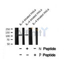 Western blot analysis of EPHA1 (Phospho-Tyr599) using IL-4 treated HeLa whole cell lysates