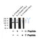 Western blot analysis of EPHA1 (Phospho-Tyr599) using IL-4 treated HeLa whole cell lysates