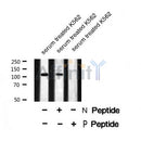Western blot analysis of EPHB1 (Phospho-Tyr928) Antibody expression in Serum treated k562 cells lysates.